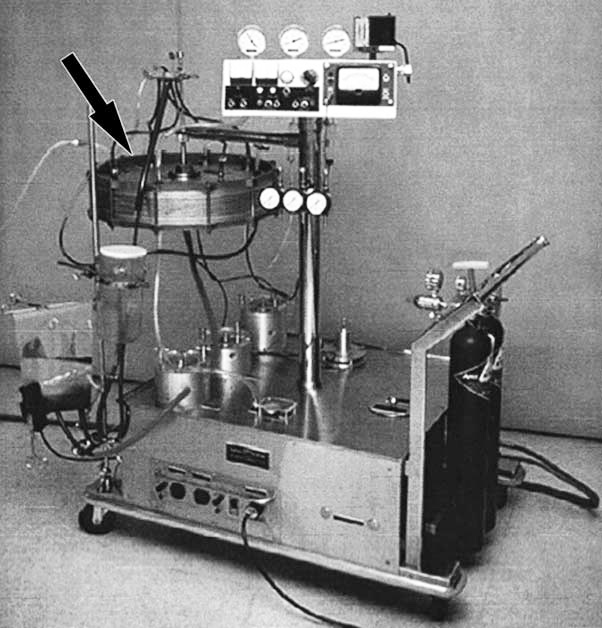 Erste berichtete ECMO